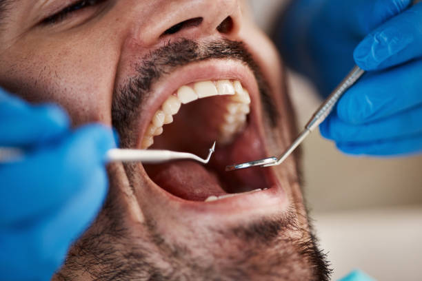 Best After-Hours Emergency Dentist in Oswego, KS